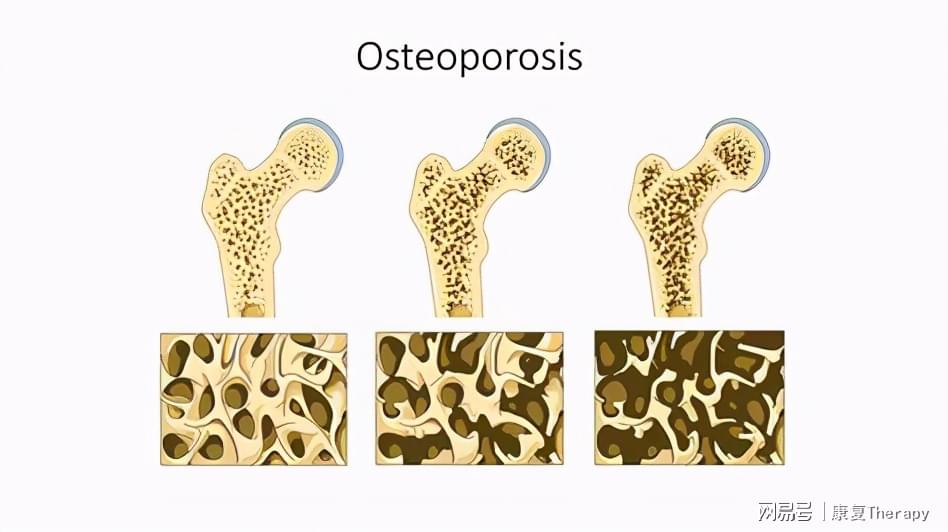 哪种钙片补钙效果好(钙片品种和区别)-硒宝网