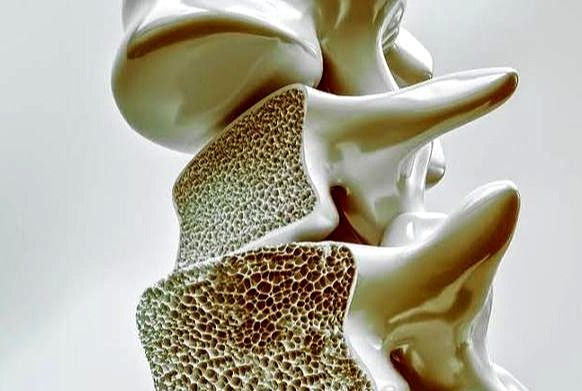 骨质疏松怎么补钙（补钙骨质疏松）-硒宝网