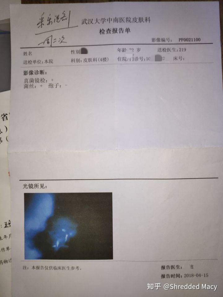 硒产品能治布病吗（硒治百病骗局）-硒宝网