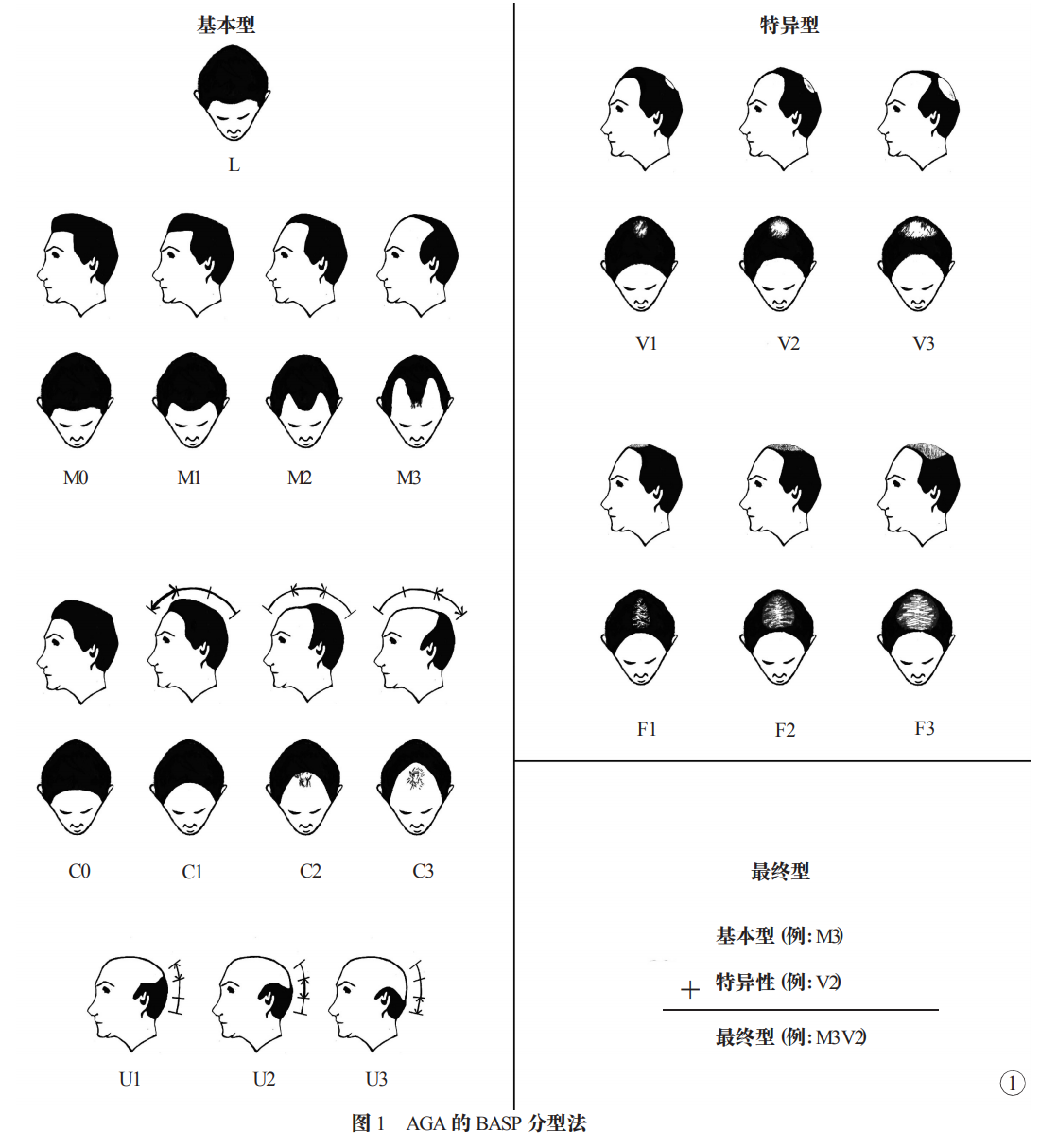 硒产品会掉头发吗(掉头发产品硒会变黑吗)-硒宝网