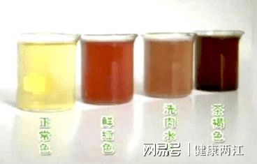 微量元素铁偏高(微量元素铁偏高有什么危害)-硒宝网