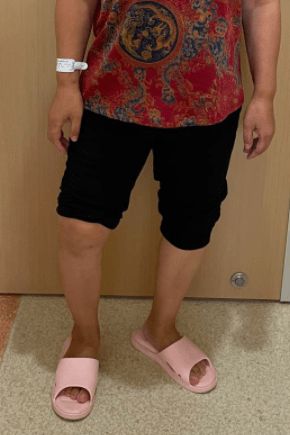 骨折补钙(骨折补钙的最佳时间)-硒宝网