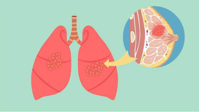 乳癌能吃硒维康吗(乳腺癌吃硒维康有效吗)-硒宝网