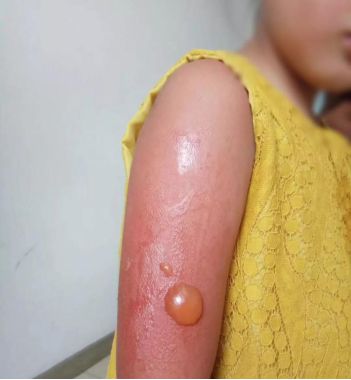 隔着玻璃晒太阳能补钙吗(隔着玻璃晒太阳可以补钙)-硒宝网