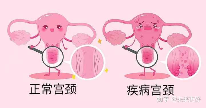 硒维康胃癌能吃么（胃癌能吃硒维康口嚼片吗）-硒宝网