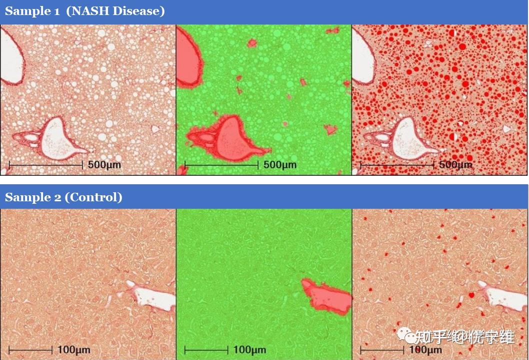 维硒康胶囊的作用（维康胶囊图片）-硒宝网