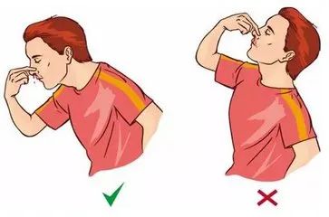 吃硒维康皮肤变黄(变皮肤吃黄硒维康有效果吗)-硒宝网