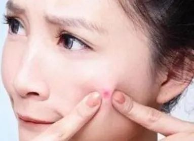 吃硒维康皮肤变黄(变皮肤吃黄硒维康有效果吗)-硒宝网