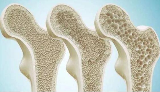 虾皮怎么吃最补钙（吃虾皮补钙效果好吗）-硒宝网