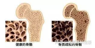 什么汤补钙（骨头汤补钙）-硒宝网