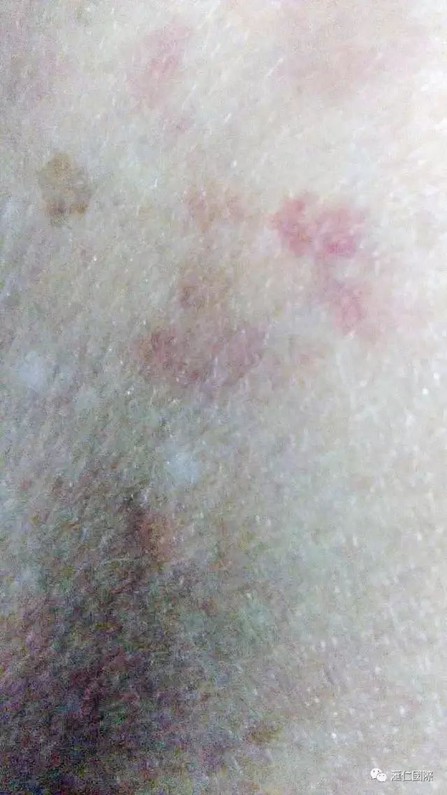 奥希维康是有机硒（奥希维康硒真的能治病吗）-硒宝网