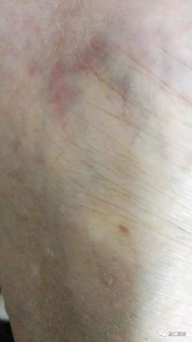 奥希维康是有机硒（奥希维康硒真的能治病吗）-硒宝网