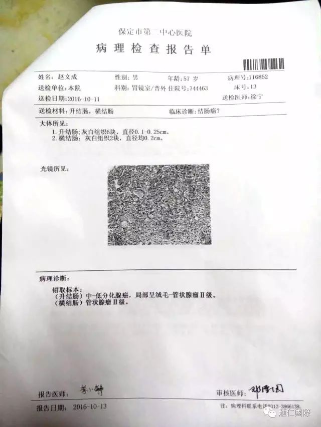 奥希维康是有机硒（奥希维康硒真的能治病吗）-硒宝网