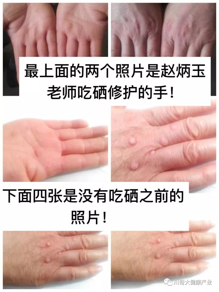 奥希维康是有机硒（奥希维康硒真的能治病吗）-硒宝网