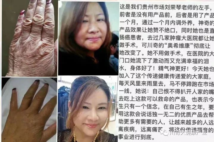 奥希维康是有机硒（奥希维康硒真的能治病吗）-硒宝网