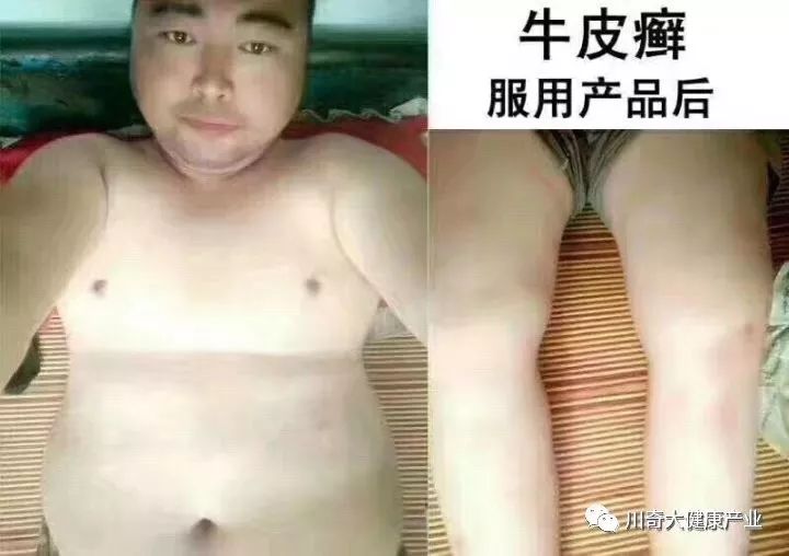 奥希维康是有机硒（奥希维康硒真的能治病吗）-硒宝网