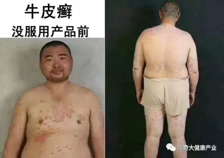 奥希维康是有机硒（奥希维康硒真的能治病吗）-硒宝网