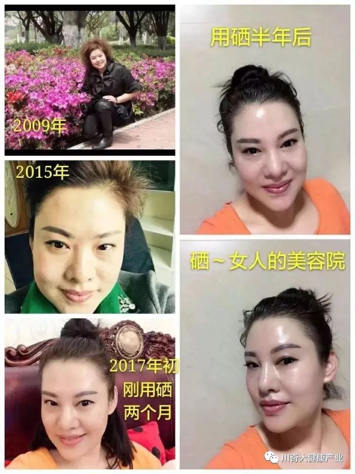 奥希维康是有机硒（奥希维康硒真的能治病吗）-硒宝网