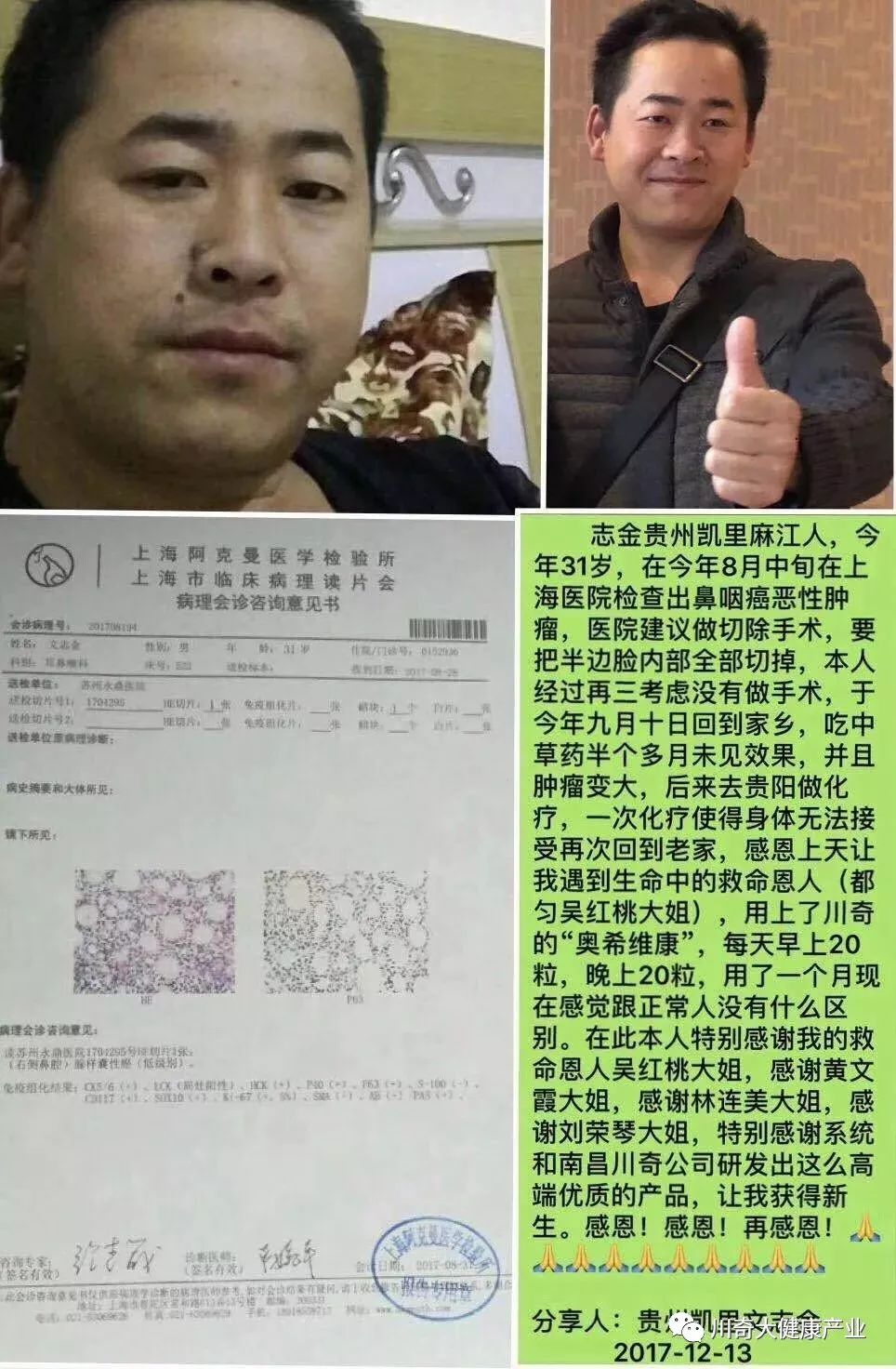 奥希维康是有机硒（奥希维康硒真的能治病吗）-硒宝网