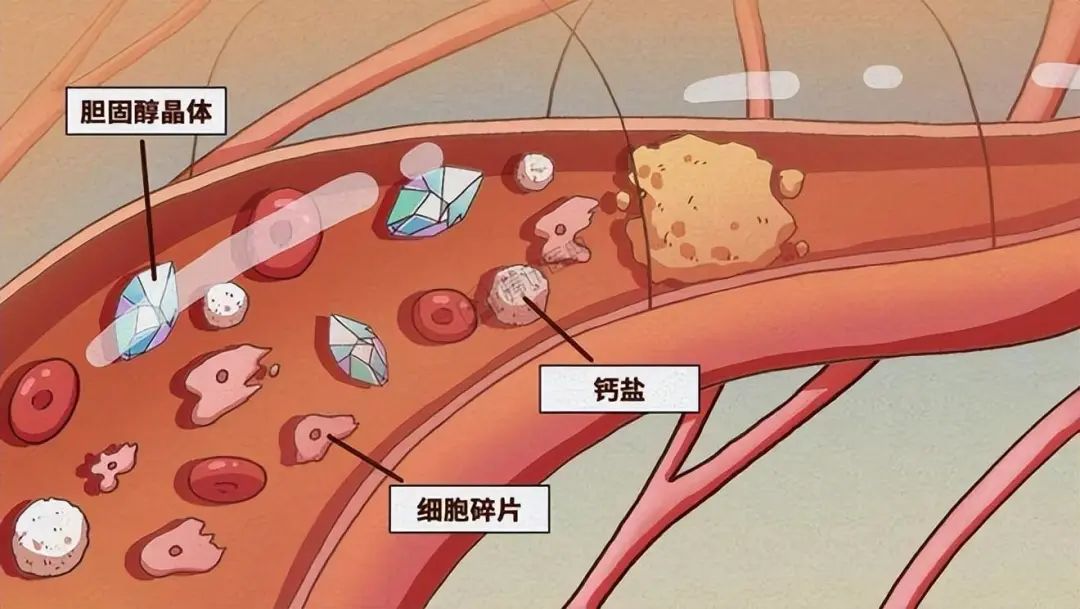 男人补钙吃什么钙片好（补钙吃男人钙片好吗）-硒宝网
