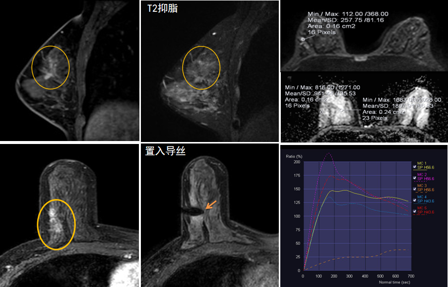 硒维康会消结节吗(吃硒可以治疗结节吗)-硒宝网