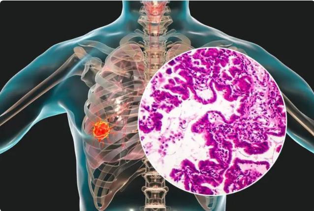 硒维康服用会热吗（硒片吃了会拉肚子吗）-硒宝网