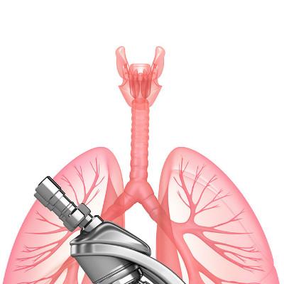 肺癌硒维康口嚼片(肺癌可以吃硒维康吗)-硒宝网