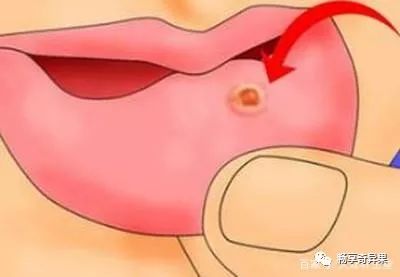 硒维康片治什么?。ㄎ灯嗌偾缓校?硒宝网