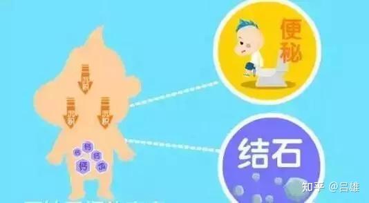 有结石的人能补钙吗（有结石的人补钙）-硒宝网