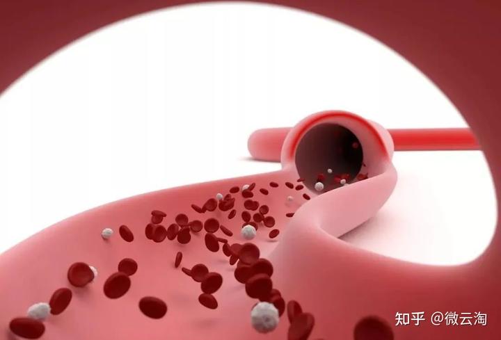 补钙过量有什么害处（过量补钙危害）-硒宝网