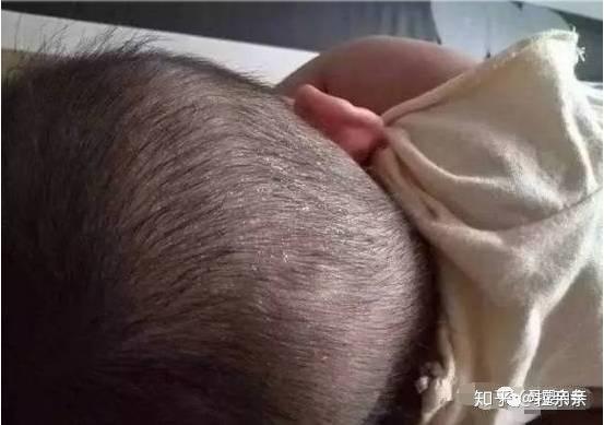 8个月宝宝需要补钙吗(宝宝补钙要补到几个月)-硒宝网