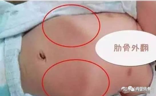 8个月宝宝需要补钙吗(宝宝补钙要补到几个月)-硒宝网