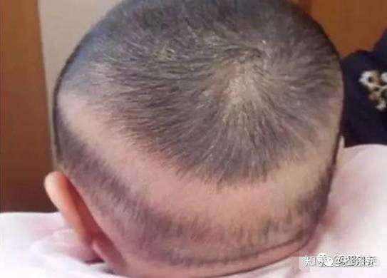 8个月宝宝需要补钙吗(宝宝补钙要补到几个月)-硒宝网