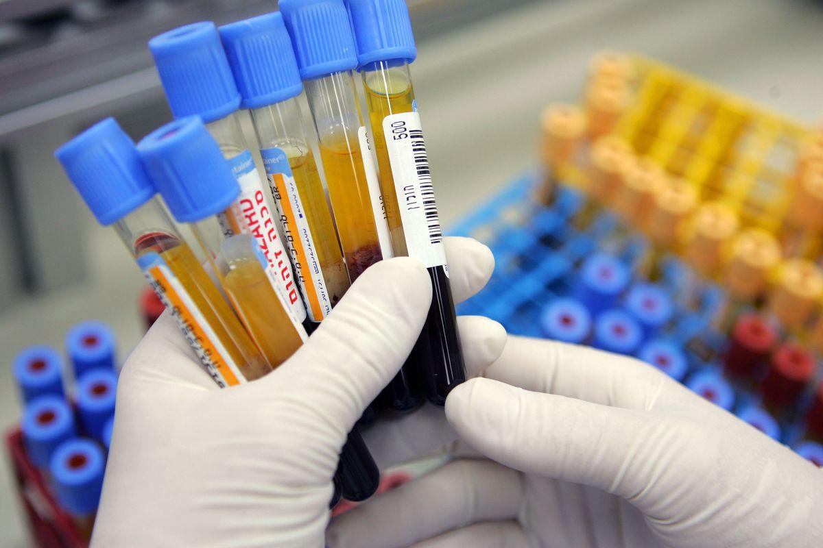 红枣可以补铁吗（红枣补铁可以长期吃吗）-硒宝网