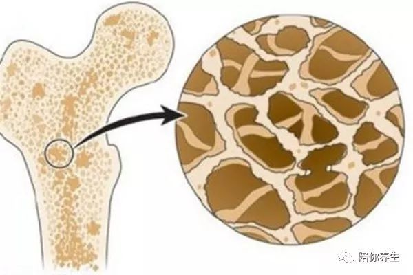 骨质增生能不能补钙(骨增生补钙有用吗)-硒宝网