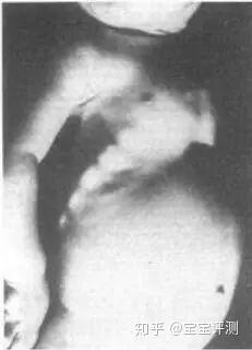 三个月宝宝怎么补钙(宝宝补充钙)-硒宝网