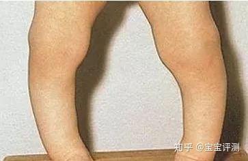 三个月宝宝怎么补钙(宝宝补充钙)-硒宝网