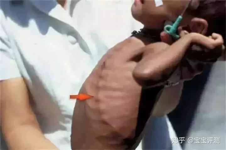 三个月宝宝怎么补钙(宝宝补充钙)-硒宝网