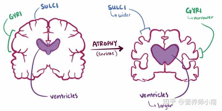 锌硒宝能经常吃吗(锌硒宝片宝宝能吃吗)-硒宝网