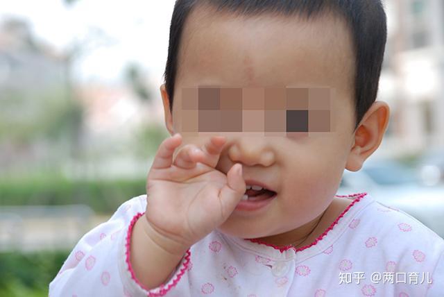 小孩缺锌吃锌硒宝(儿童缺锌硒)-硒宝网