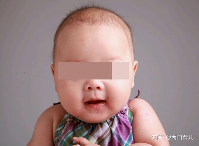 小孩缺锌吃锌硒宝(儿童缺锌硒)-硒宝网