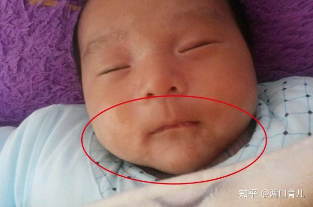 小孩缺锌吃锌硒宝(儿童缺锌硒)-硒宝网