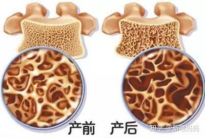 产后补钙(产后补钙每天补多少)-硒宝网