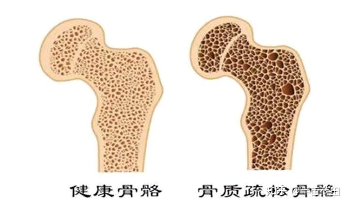 补钙片（补钙片哪个牌子好效果好）-硒宝网