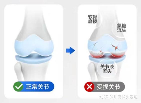 补钙片(补钙片的作用与功效)-硒宝网