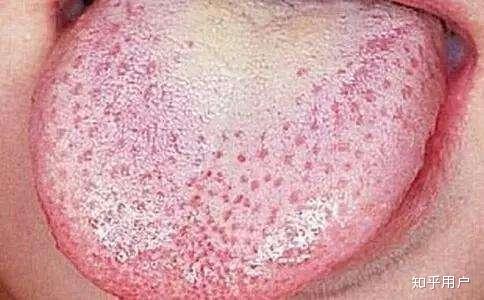 金水宝与锌硒宝片（锌硒宝的成分）-硒宝网