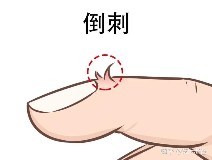 缺锌缺硒吃锌晒宝(锌硒缺乏)-硒宝网