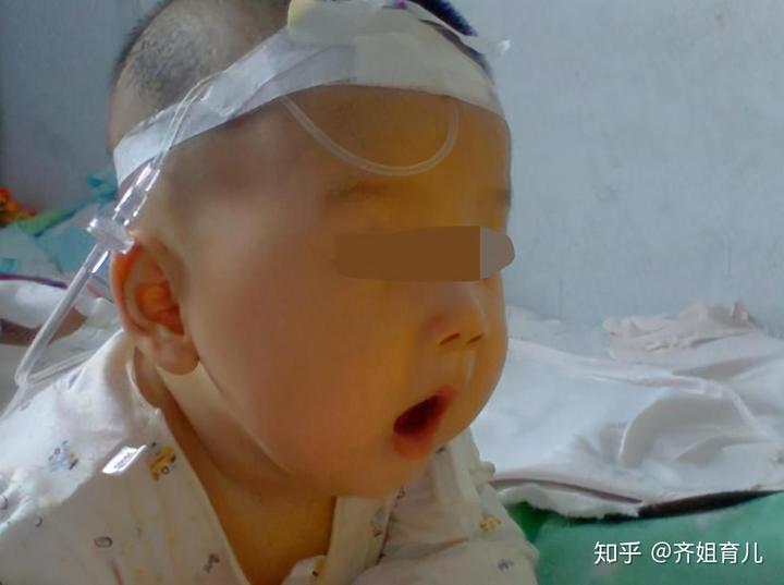 缺锌缺硒吃锌晒宝(缺锌硒吃什么药)-硒宝网