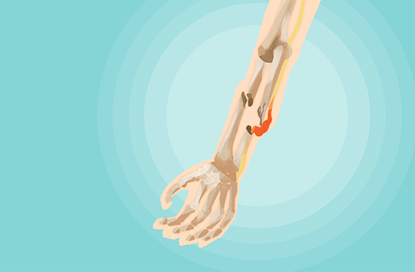 青春期需要补钙吗(补钙青春期需要补钙吗)-硒宝网