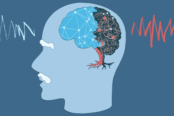 青春期需要补钙吗(补钙青春期需要补钙吗)-硒宝网